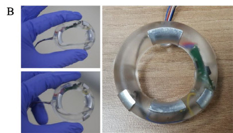 조산을 진단하고 자궁 수축을 억제하는 전자약    KIST 제공